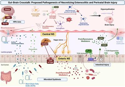 Gut-Brain cross talk: The pathogenesis of neurodevelopmental impairment in necrotizing enterocolitis